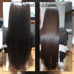 repolarización-magic